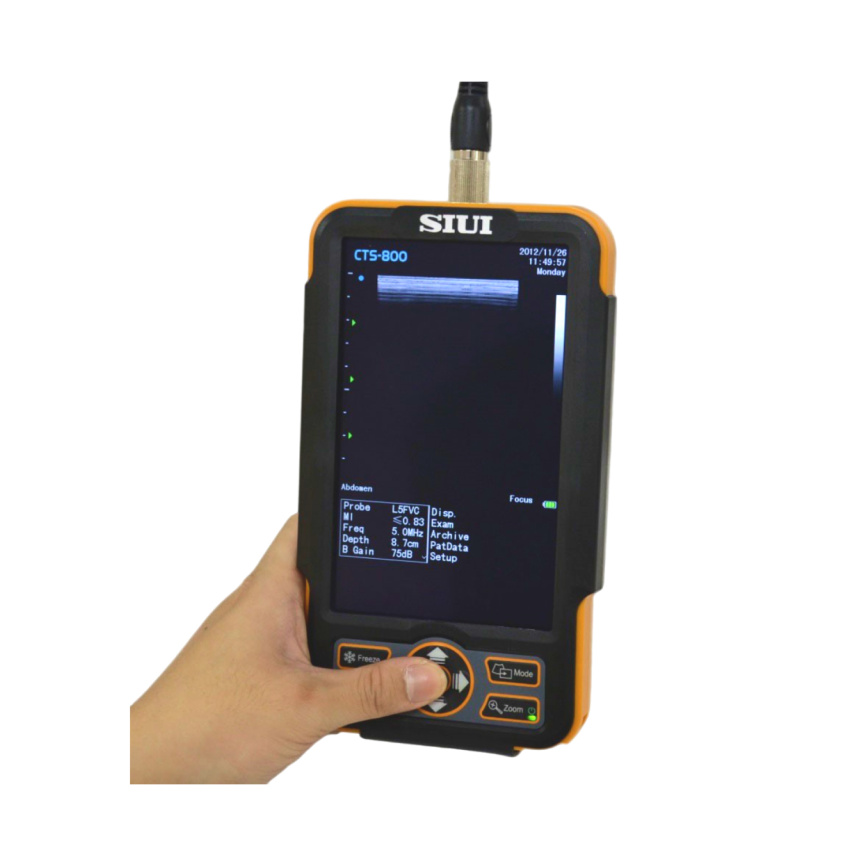 Портативный ветеринарный Ультразвуковой сканер SIUI CTS-800V фото 3