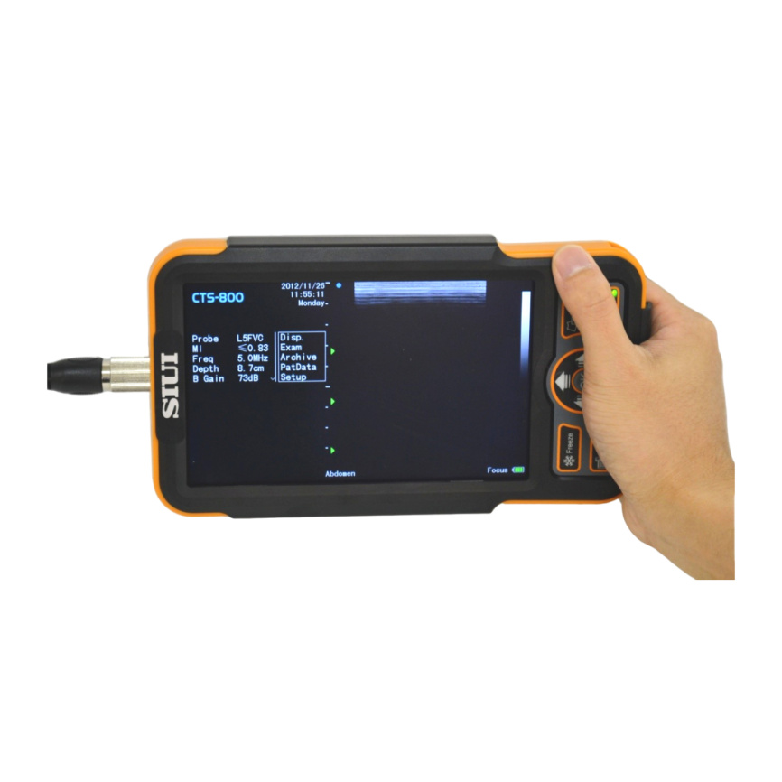 Портативный ветеринарный Ультразвуковой сканер SIUI CTS-800V фото 4
