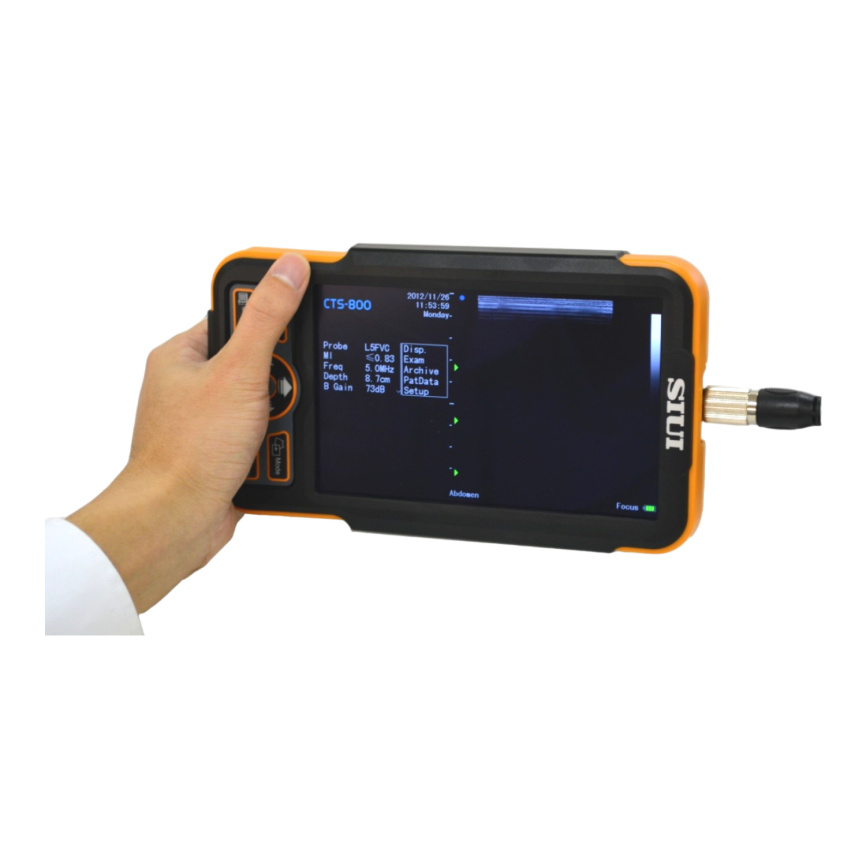 Портативный ветеринарный Ультразвуковой сканер SIUI CTS-800V фото 2