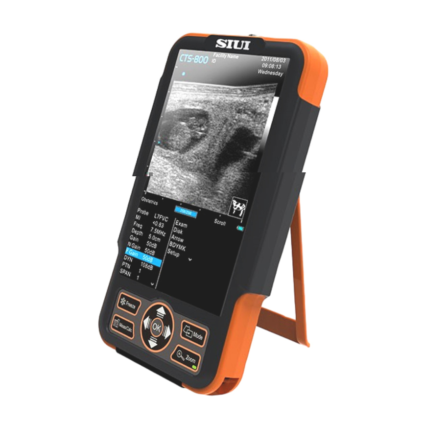 Портативный ветеринарный Ультразвуковой сканер SIUI CTS-800V фото 1